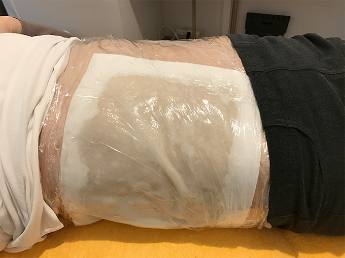温熱ヒマシ油シップ