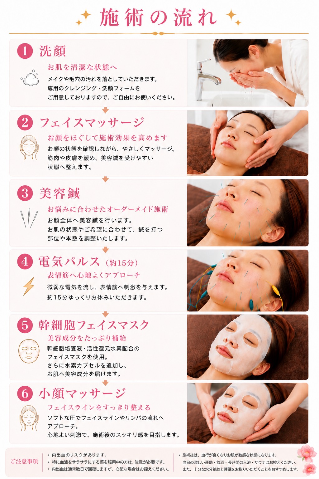 電気パルス×幹細胞美顔鍼施術の流れ①洗顔②フェイスマッサージ③美容鍼④電気パルス（約15分）⑤幹細胞フェイスマスク⑥小顔マッサージ